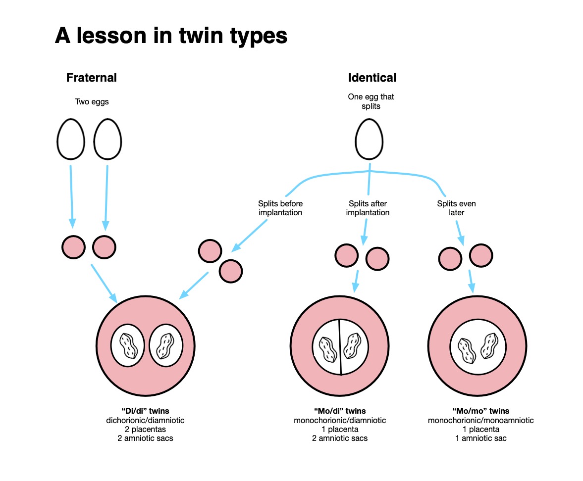 Throw Anything At Me, As Long As It's Not Conjoined Twins - The Seattle ...